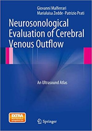 Neurosonological Evaluation of Cerebral Venous Outflow An Ultrasound Atlas