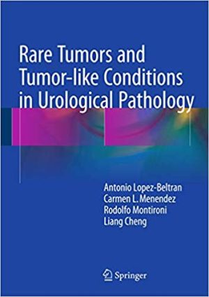 Rare Tumors and Tumor like Conditions in Urological Pathology