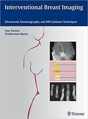 Interventional Breast Imaging Ultrasound Mammography and MR Guidance Techniques