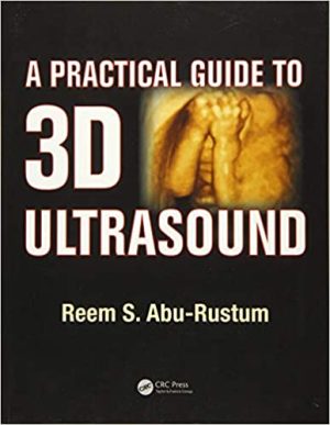 A Practical Guide to 3D Ultrasound