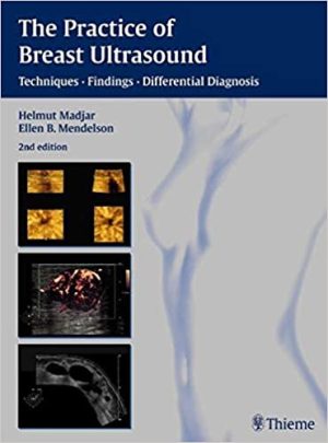 The Practice of Breast Ultrasound Techniques Findings Differential Diagnosis 2nd Edition