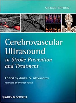Cerebrovascular Ultrasound in Stroke Prevention and Treatment 2nd Edition