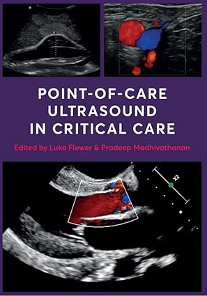 Point Of Care Ultrasound in Critical Care