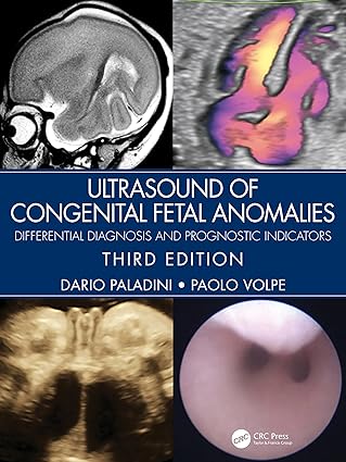 Ultrasound of Congenital Fetal Anomalies Differential Diagnosis and Prognostic Indicators 3rd Edition