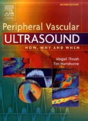 Peripheral Vascular Ultrasound How Why and When 2nd Edition
