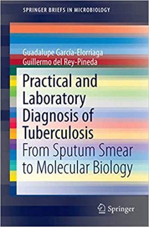 Practical and Laboratory Diagnosis of Tuberculosis From Sputum Smear to Molecular Biology