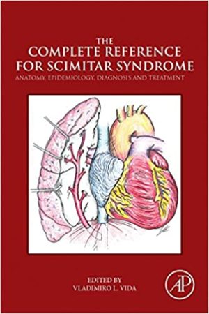 The Complete Reference for Scimitar Syndrome Anatomy Epidemiology Diagnosis and Treatment