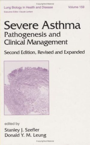 Severe Asthma Pathogenesis and Clinical Management