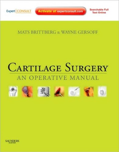 Cartilage Surgery An Operative Manual
