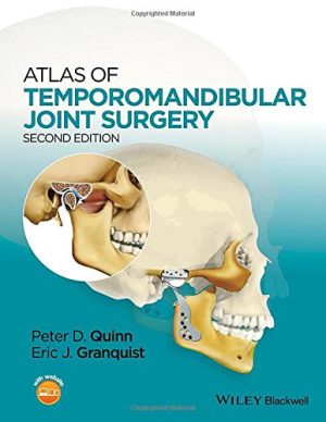 Atlas of Temporomandibular Joint Surgery 2nd Edition