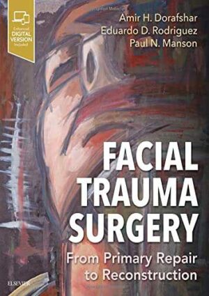 Facial Trauma Surgery From Primary Repair to Reconstruction