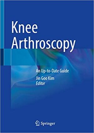 Knee Arthroscopy An Up to Date Guide