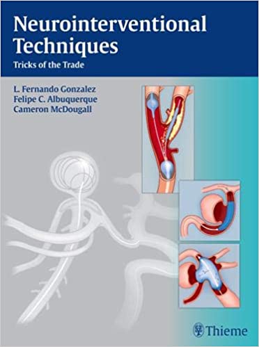 Neurointerventional Techniques Tricks of the Trade