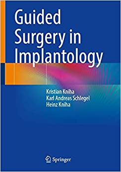 Guided Surgery in Implantology