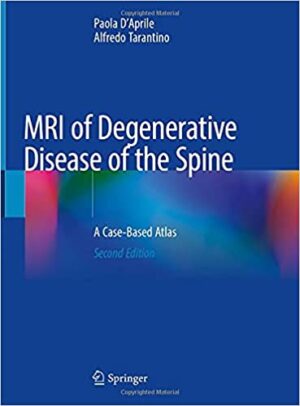 MRI of Degenerative Disease of the Spine A Case Based Atlas 2nd Ed