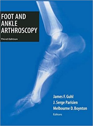 Foot and Ankle Arthroscopy 3rd Ed