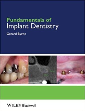 Fundamentals Of Implant Dentistry