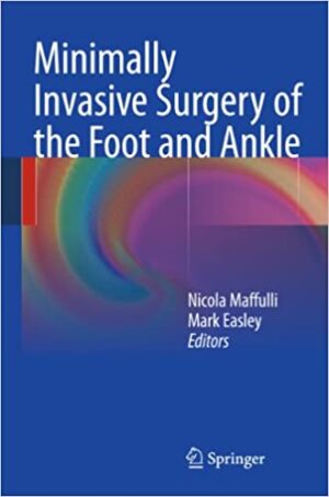 Minimally Invasive Surgery of the Foot and Ankle