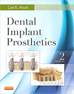 Dental Implant Prosthetics 2nd Ed