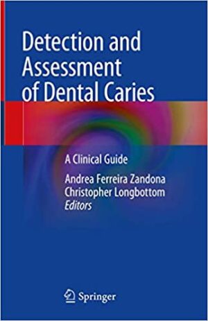 Detection and Assessment of Dental Caries A Clinical Guide