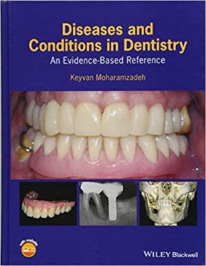 Diseases and Conditions in Dentistry An Evidence Based Reference