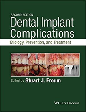 Dental Implant Complications Etiology Prevention And Treatment 2nd Ed