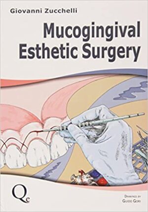 Mucogingival Esthetic Surgery 2 Vol Set