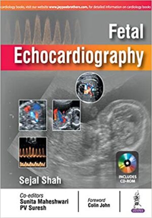 Fetal Echocardiography By Sejal Shah