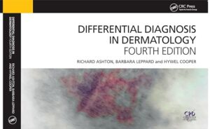 Differential Diagnosis in Dermatology 4th Edition