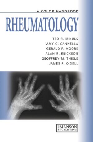 Rheumatology A Color Handbook