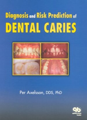 Diagnosis and Risk Prediction of Dental Caries Volume 2
