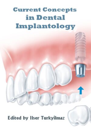 Current Concepts in Dental Implantology