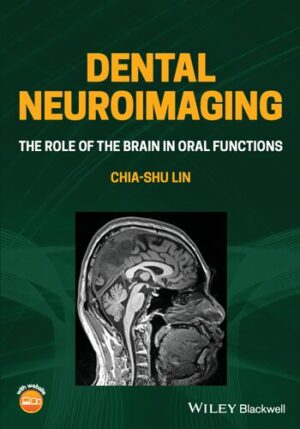 Dental Neuroimaging The Role of the Brain in Oral Functions